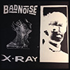 xray